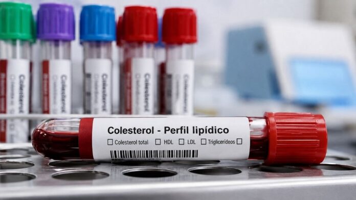 colesterol