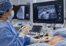 Crioablación contra el cáncer de mama: cómo funciona esta alternativa que busca evitar la cirugía