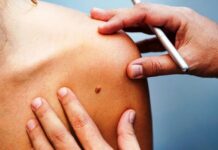 Vacuna contra el VPH gratis en CDMX 2026: quiénes pueden recibirla y cómo encontrar los módulos VPH