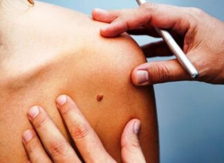 Vacuna contra el VPH gratis en CDMX 2026: quiénes pueden recibirla y cómo encontrar los módulos VPH